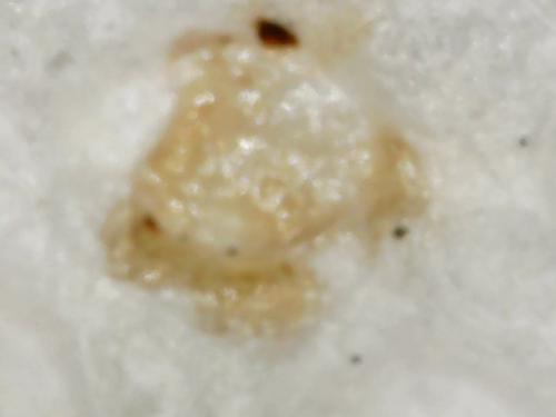 EGG WHITE BLACK SPOT (5)