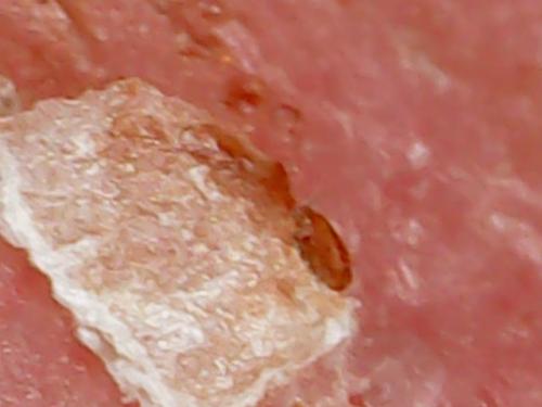 SPINE BASE HYDRO GEL PROGRESS (7)