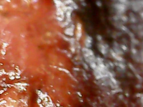 SPINE BASE HYDRO GEL PROGRESS (2)