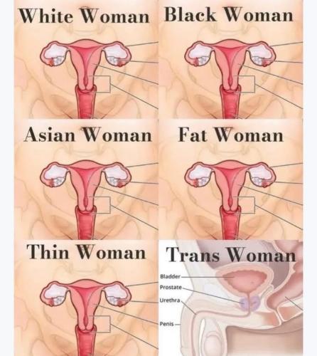 trans wahmon is not woman