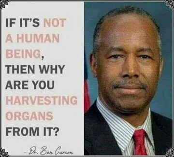 ben carson g