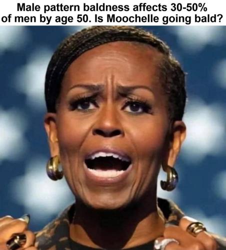 Is Moochelle going bald.960px
