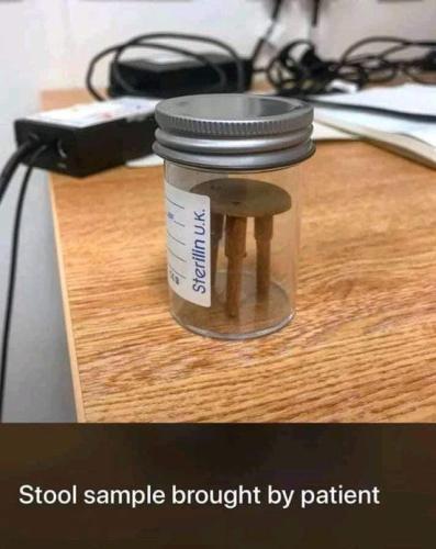 stool sample