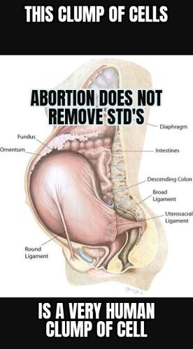 ZomboMeme 17092025120145