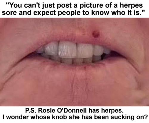 Rosie has Herpes.768px