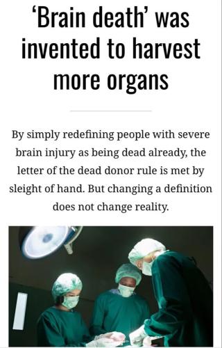 brain-death-invented