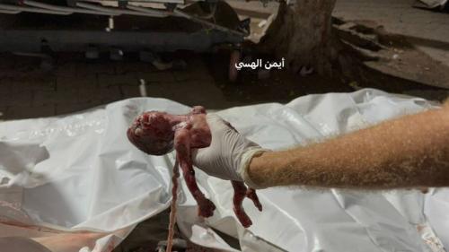 Gz5wmrkbEAARBjZ