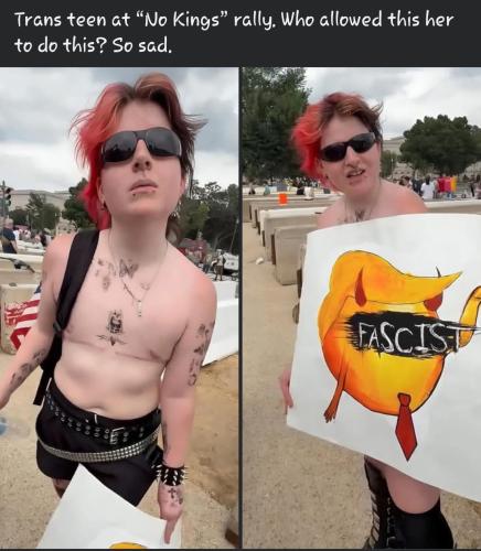 Teens had her breast removed