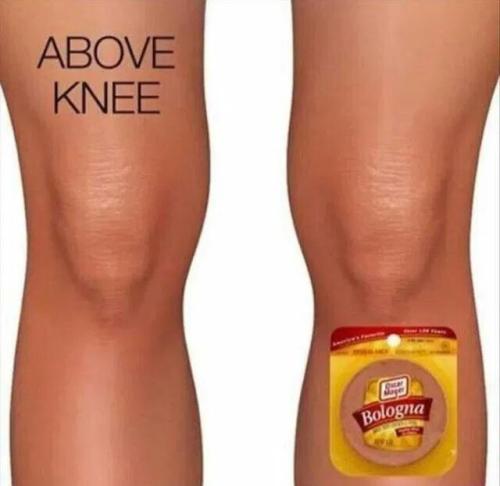 above-knee-baloney