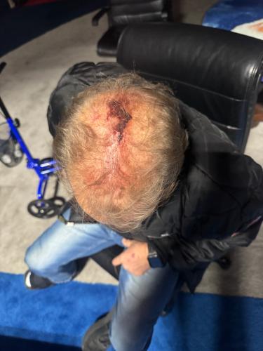 E97BA32A-FC2B-4033-9BCC-C838269918B3