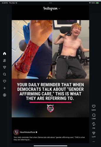 87571409-f887-406c-a610-662833cdd0d9