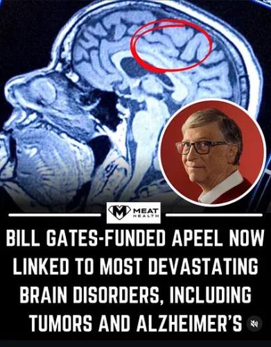 apeel-brain-diseases