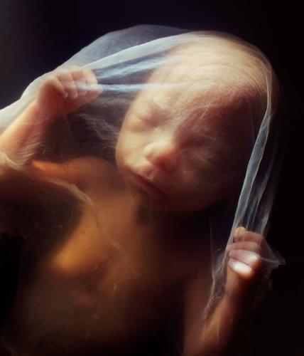 615491862_1317790403711418_9002287865976209282_n