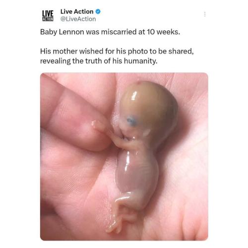 615931872_1310644984435051_5121349837895547044_n