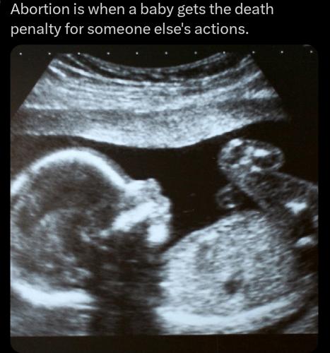 Screenshot_20260222_074436_X