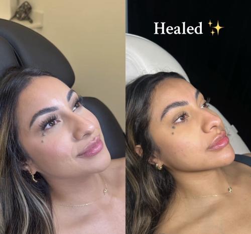 temp_image_25400FC0-D0DF-4802-96DA-B53A2C0B7331