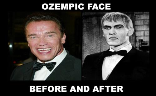 Ozempic Face Schwarzenegger.768px