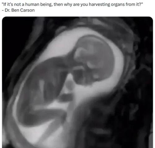 108615baf0da9066400b13cbcbb33403