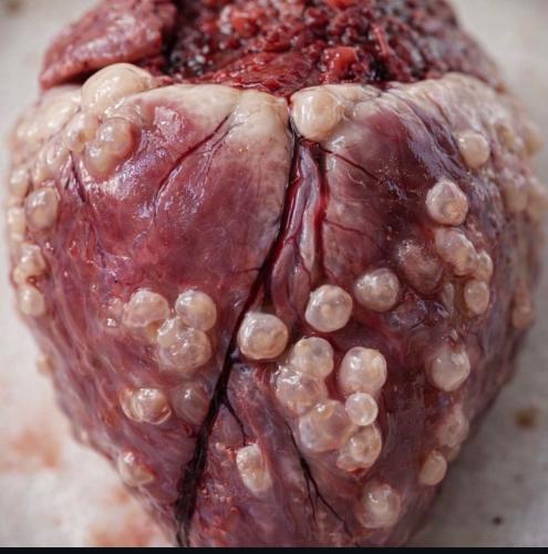 The bubbles around the heart are larvae from ingested tapeworm that traveled through bloodstream