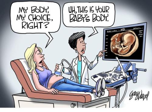 pro life 64