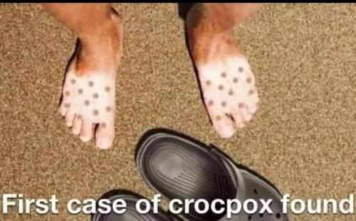 Crocpox