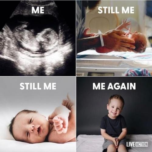 pro life 67