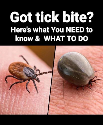 Got tick bite?