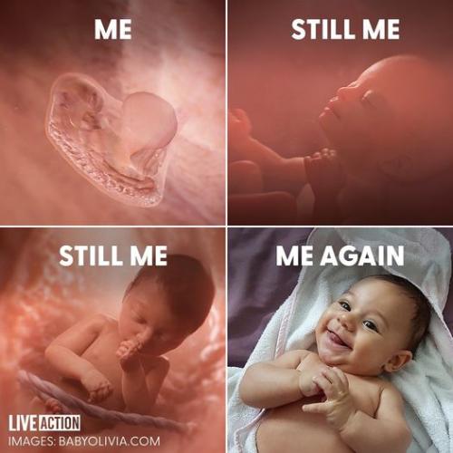 pro life 75