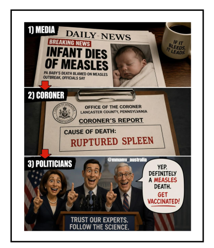 ruptured speen