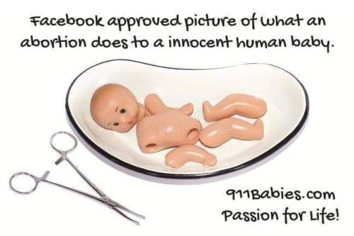 pro life 88