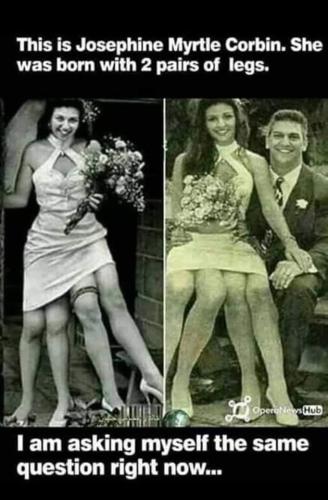 2_pairs_of_legs
