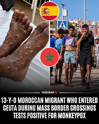 ILLEGAL DESEASES BORDER