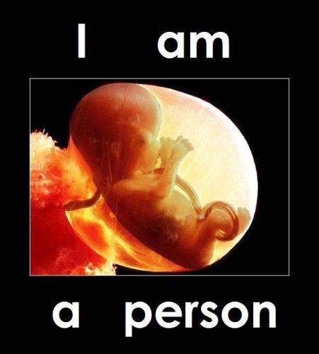 pro life 4