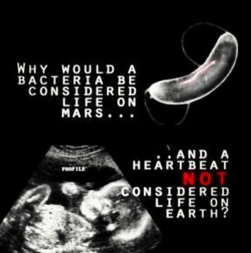 pro life 5