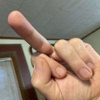Al