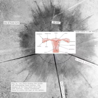 cynicalpinnacl2